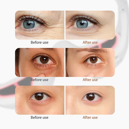 Under-Eye Red Light Therapy